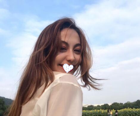 徐州時光洪揚整形雙眼皮術(shù)后兩個月效果 徐州時光洪揚整形雙眼皮術(shù)后兩個月效果