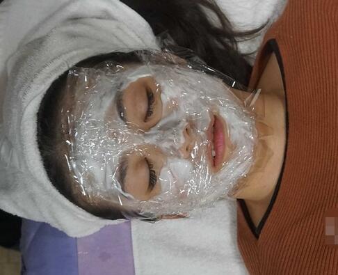 汕頭曙光整形皮秒激光祛斑后 汕頭曙光整形皮秒激光祛斑后