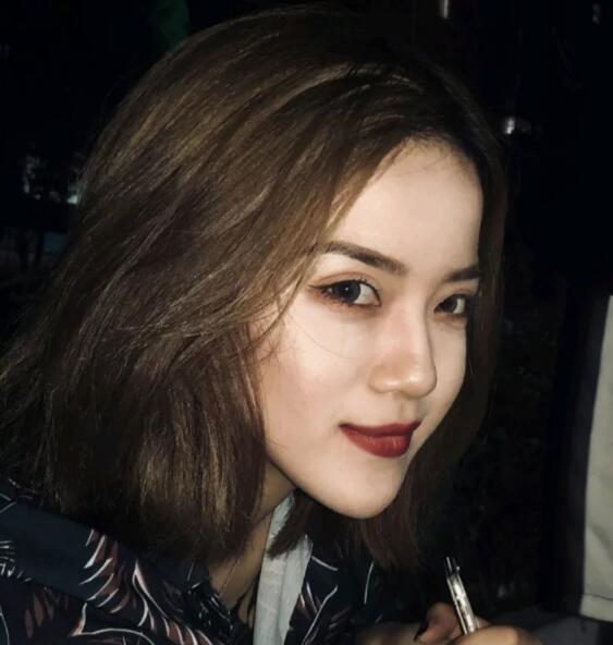 重慶華美下頜角整形術(shù)后兩個(gè)月效果