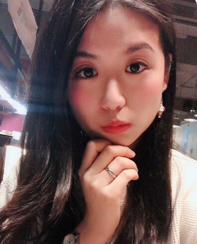 汕頭曙光整形皮秒激光祛斑一個(gè)月效果 汕頭曙光整形皮秒激光祛斑一個(gè)月效果