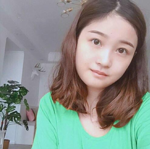 重慶美聯(lián)臣下頜角整形一個(gè)月效果 重慶美聯(lián)臣下頜角整形一個(gè)月效果