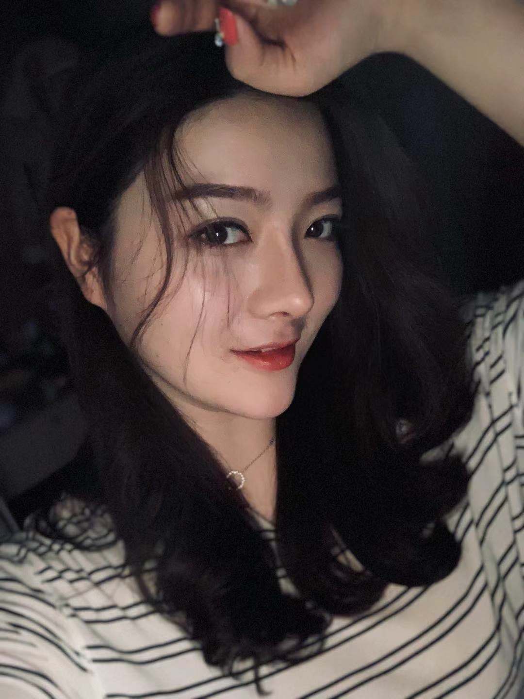 北京圣嘉榮二次鼻修復(fù)術(shù)后一個(gè)月 北京圣嘉榮二次鼻修復(fù)術(shù)后一個(gè)月