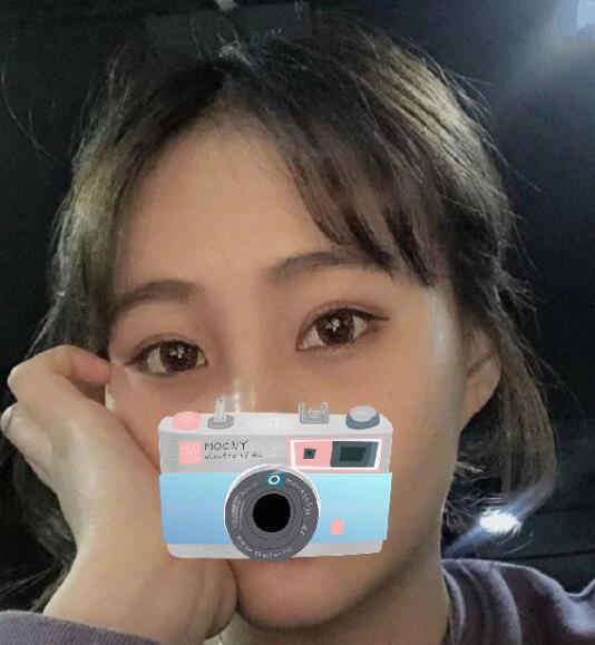 重慶華美整形下頜角整形術(shù)后三個(gè)月效果