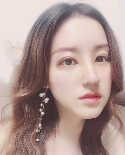 北京圣嘉榮整形呂玲玲硅膠隆鼻術(shù)后一個月效果