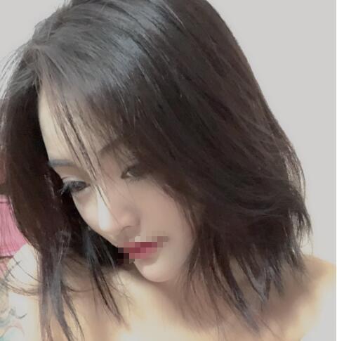 上海賽美瑞整形張化舉鼻綜合一個(gè)月效果 上海賽美瑞整形張化舉鼻綜合一個(gè)月效果