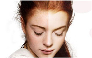 北京伊士波醫(yī)療激光祛斑價(jià)格