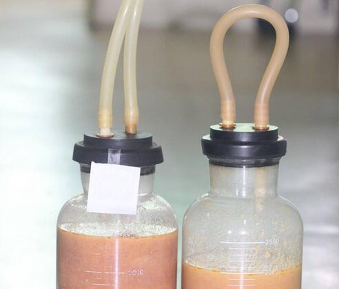 青島大學醫(yī)學院附屬醫(yī)院整形美容燒傷科陳振宇雙腿吸脂吸出的脂肪 青島大學醫(yī)學院附屬醫(yī)院整形美容燒傷科陳振宇雙腿吸脂吸出的脂肪