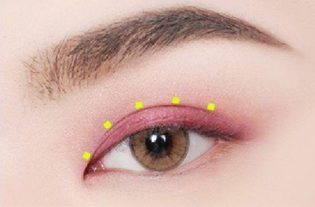 成都濟(jì)慈德美醫(yī)療美容門診部做雙眼皮