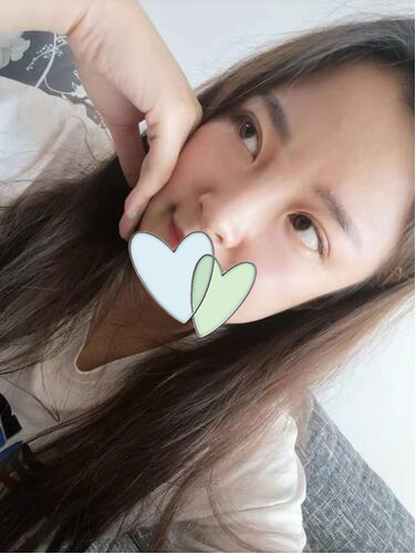 雙眼皮手術(shù)前