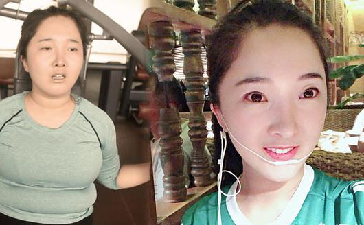 埋線減肥是什么？中醫(yī)診所里推出的埋線減肥真有用嗎，有科學(xué)依據(jù)嗎？