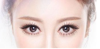 錦州醫(yī)療整形美容醫(yī)院做開(kāi)眼角