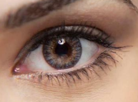 淮安恩尚整形開眼角術(shù)后效果