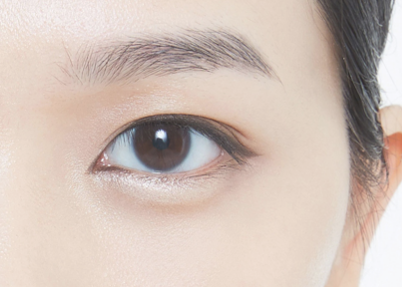 遼寧奉天中醫(yī)院醫(yī)學整形美容中心開眼角