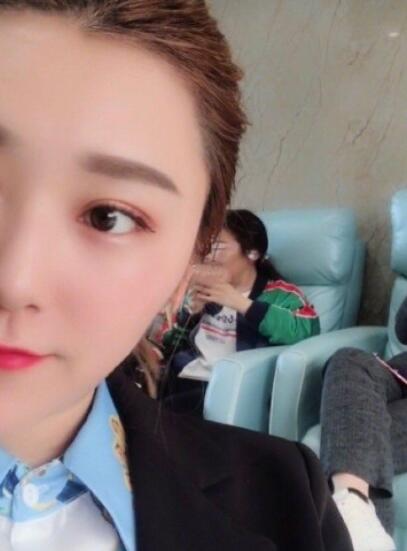 荊州華美整形醫(yī)院沈沛全切雙眼皮案例分享