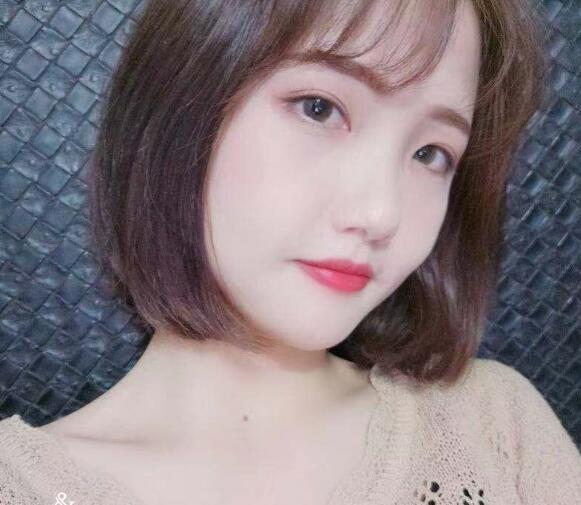 做切開(kāi)雙眼皮恢復(fù)中的我 做切開(kāi)雙眼皮恢復(fù)中的我