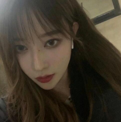 玻尿酸豐下巴完全恢復(fù)后的效果 玻尿酸豐下巴完全恢復(fù)后的效果