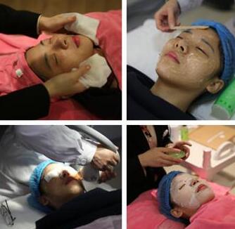 激光祛斑手術(shù)中