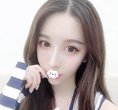 北京博士園整形醫(yī)生郭以文假體隆鼻修復(fù)前后效果對比圖