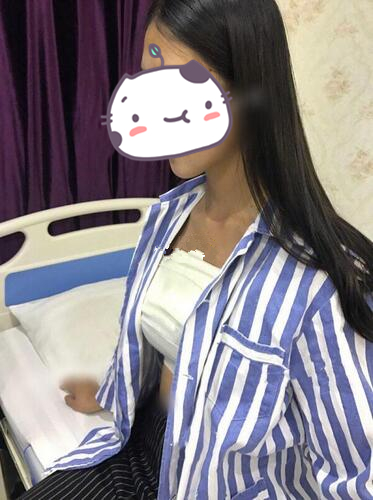 琴面假體隆胸前 琴面假體隆胸前