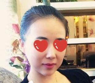 上海美萊醫(yī)療美容門診部伊維蘭隆下巴的優(yōu)勢