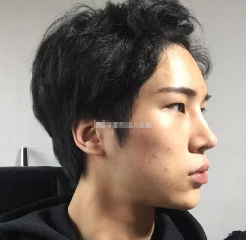 5-20032GJ444208.jpg 5-20032GJ444208.jpg