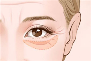 邵陽(yáng)曹家醫(yī)療美容門診部激光祛眼袋