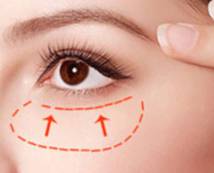 深圳廣濟門診部醫(yī)療美容科激光祛眼袋