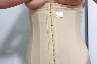 顧鵬腹部吸脂案例展示 顧鵬腹部吸脂案例展示