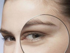 深圳陽光整形美容醫(yī)院激光祛眼袋