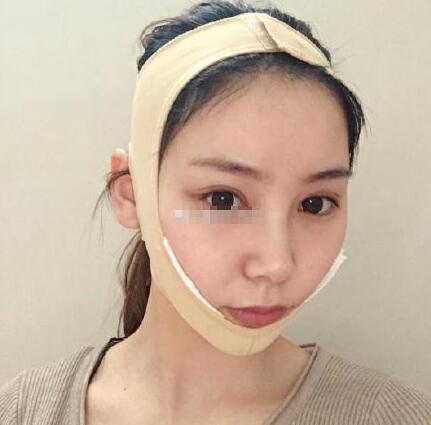 下頜角手術(shù)第一天：