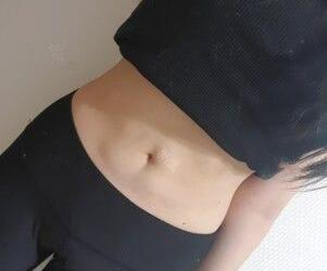 廣州星團醫(yī)學(xué)整形醫(yī)生顧鵬做腹部吸脂效果怎么樣？顧鵬腹部吸脂案例展示