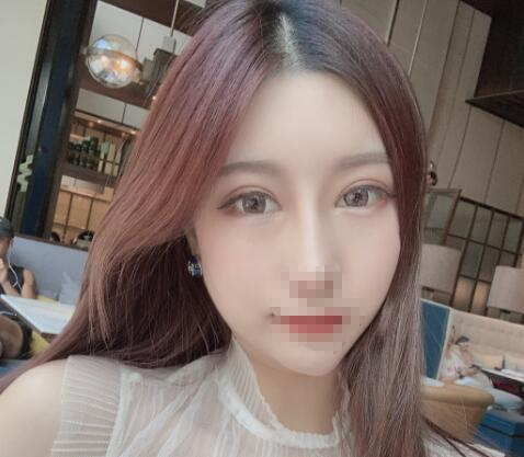 北京彤美整形醫(yī)院專(zhuān)家李長(zhǎng)賦做鼻部綜合整形怎么樣？