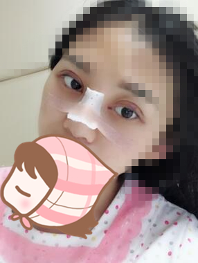 手術(shù)之后恢復(fù)效果。