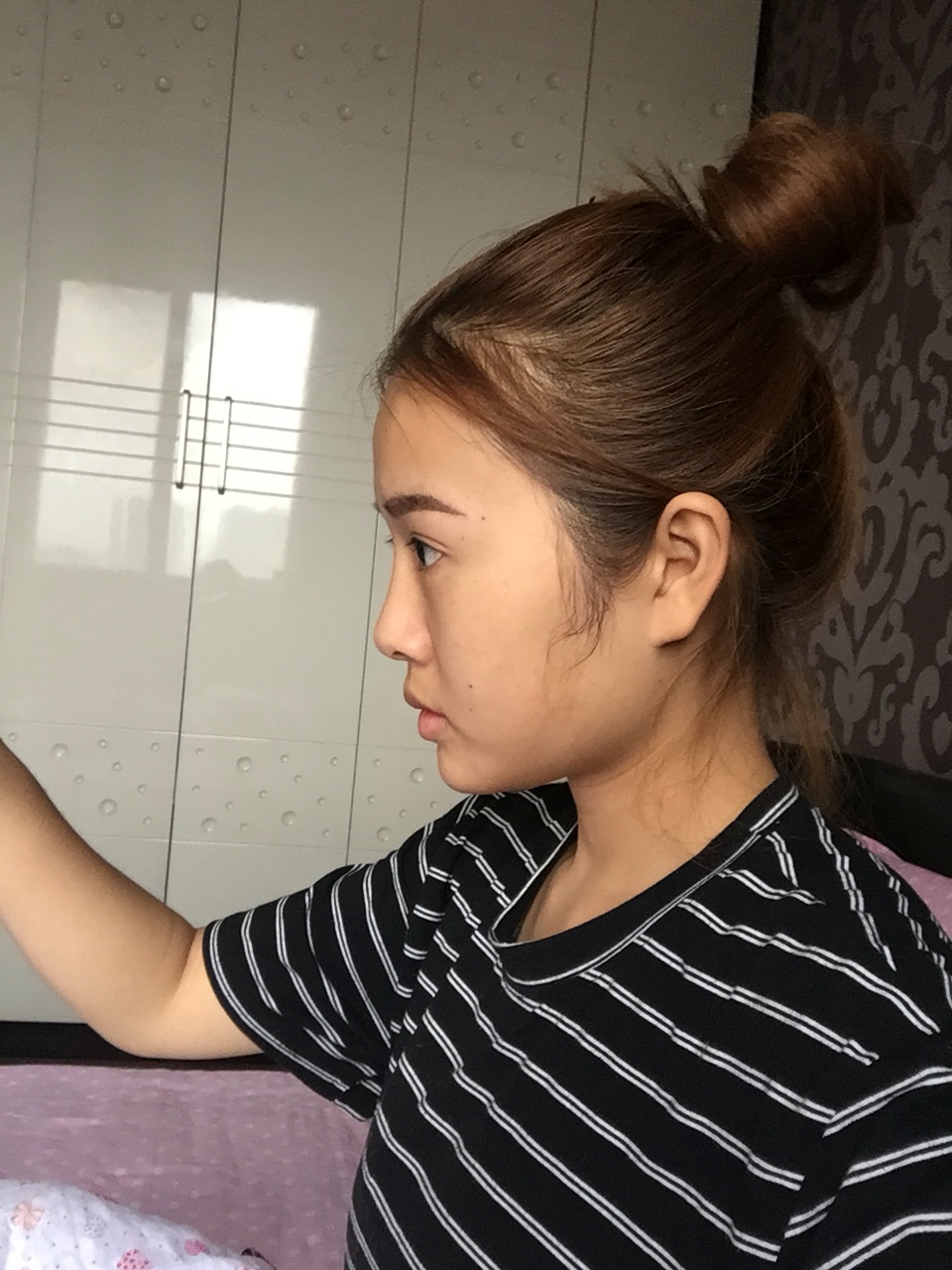 做完手術(shù)后 做完手術(shù)后