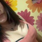 南寧伊美整形醫(yī)生凌宏量做自體脂肪隆胸怎么樣？自體脂肪隆胸案例