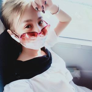 雙眼皮手術(shù)第五天 雙眼皮手術(shù)第五天