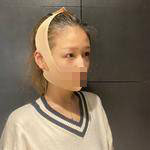 楊力醫(yī)生案例展示 楊力醫(yī)生案例展示