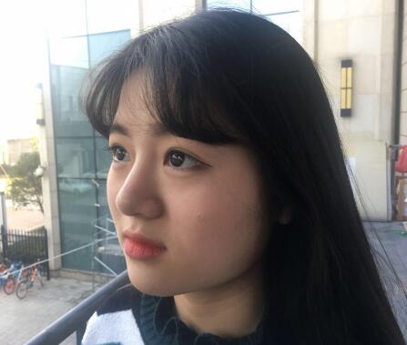 海南瑞韓醫(yī)學(xué)整形專家馬愛(ài)紅做玻尿酸豐面頰怎么樣?玻尿酸豐面頰案例展示 海南瑞韓醫(yī)學(xué)整形專家馬愛(ài)紅做玻尿酸豐面頰怎么樣?玻尿酸豐面頰案例展示