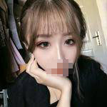 濟(jì)南鵬愛整形醫(yī)生楊力做顴骨顴弓整形技術(shù)怎么樣？楊力醫(yī)生案例展示