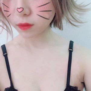 孫軼峰做假體隆胸案例效果對比圖 孫軼峰做假體隆胸案例效果對比圖