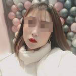 上海瑞麗整形醫(yī)生金炳建做肋軟骨隆鼻技術(shù)怎么樣？金炳建做肋軟骨隆鼻案例