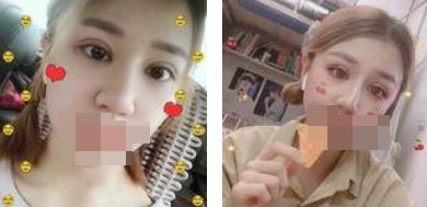 做了全切雙眼皮不僅外表變美了，內(nèi)心也更加自信了