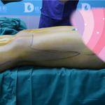 做完雙腿吸脂手術(shù)，穿上我的長(zhǎng)筒靴，盡顯女性魅力！