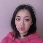 術(shù)后照片 術(shù)后照片