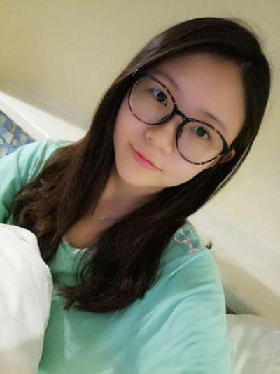 海南添美整形外科醫(yī)生王曉軍做自體軟骨隆鼻+雙眼皮+祛眼袋案例效果對(duì)比圖