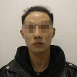 做完隆鼻失敗修復(fù)手術(shù)，再看自己儼然屬于超模中的一員了