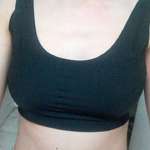 手術(shù)前的照片 手術(shù)前的照片