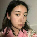 做完雙眼皮手術眼睛更加迷人了，眼睛自己會撩小哥哥