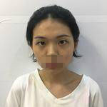 手術(shù)前的照片 手術(shù)前的照片