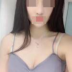 自體脂肪隆胸+隆鼻后形象瞬間提升，對(duì)生活更加自信了